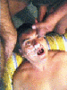 facial